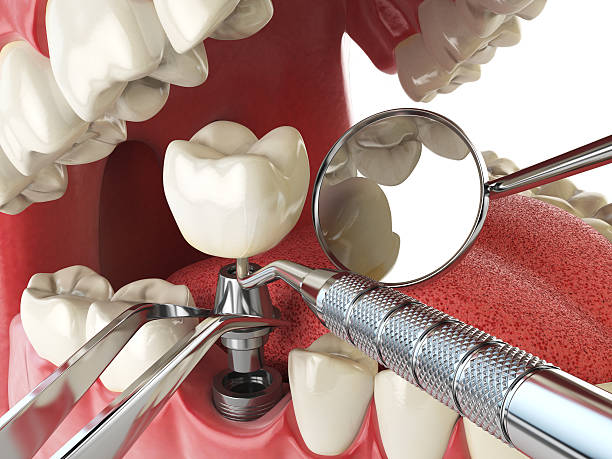 Best Weekend Emergency Dentist in Kilmarnock, VA
